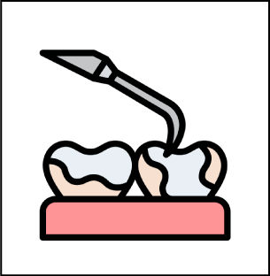 TEETH CLEANING